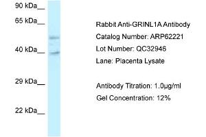 Western Blotting (WB) image for anti-Glutamate Receptor, Ionotropic, N-Methyl D-Aspartate-Like 1A (GRINL1A) (C-Term) antibody (ABIN2789069) (POLR2M anticorps  (C-Term))