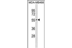 Western blot analysis in MDA-MB468 cell line lysates (35ug/lane). (KCNK6 anticorps  (C-Term))