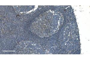 IHC analysis of TIMM8A/DDP using anti-TIMM8A/DDP antibody (ABIN7600039). (TIMM8A/DDP anticorps  (AA 14-97))