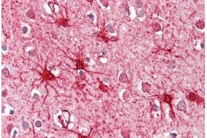 Image no. 2 for anti-Glutamate Dehydrogenase 1 (GLUD1) (AA 93-107) antibody (ABIN1496046)