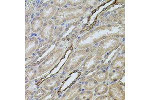 Immunohistochemistry of paraffin-embedded rat kidney using CHRFAM7A antibody (ABIN5975203) at dilution of 1/100 (40x lens). (CHRFAM7A anticorps)