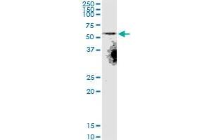 SLC22A8 monoclonal antibody (M02), clone 3C11.