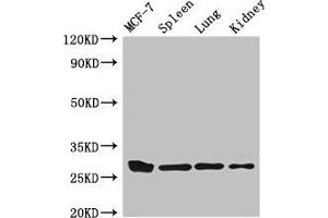 Western Blot Positive WB detected in: MCF-7 whole cell lysate, Mouse spleen tissue, Mouse lung tissue, Mouse kidney tissue All lanes: CMA1 antibody at 3 μg/mL Secondary Goat polyclonal to rabbit IgG at 1/50000 dilution Predicted band size: 28, 15 kDa Observed band size: 28 kDa