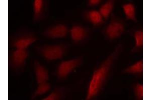 Immunofluorescence staining of methanol-fixed HeLa cells using GATA1 (phospho-Ser310) antibody (E011042, Red) (GATA1 anticorps  (pSer310))
