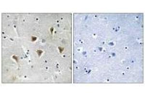 Immunohistochemistry analysis of paraffin-embedded human brain tissue using MTERF antibody. (MTERF anticorps)