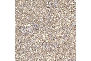 IHC analysis of RBMS1 using anti-RBMS1 antibody (ABIN7601195).
