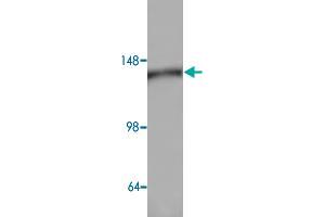 Western blot analysis of HeLa cell lysate with AP3D1 polyclonal antibody  at 1:500 dilution.