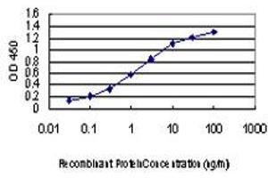 Detection limit for recombinant GST tagged PAK1 is approximately 0. (PAK1 anticorps  (AA 191-280))
