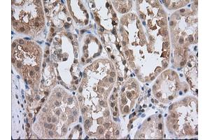 Image no. 6 for anti-Acetyl-CoA Acetyltransferase 2 (ACAT2) antibody (ABIN1496402) (ACAT2 anticorps)