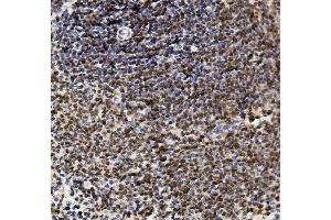 IHC analysis of U2AF2 using anti-U2AF2 antibody (ABIN7600793). (U2AF2 anticorps  (AA 238-470))