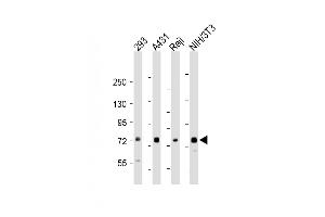 All lanes : Anti-TAK1 (Ser439) Antibody at 1:1000-1:2000 dilution Lane 1: 293 whole cell lysate Lane 2: A431 whole cell lysate Lane 3: Raji whole cell lysate Lane 4: NIH/3T3 whole cell lysate Lysates/proteins at 20 μg per lane. (TR4 anticorps  (Ser439))