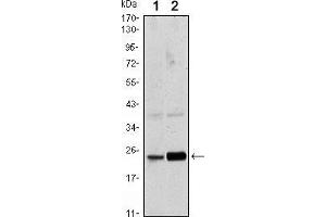 Western blot analysis using Rab10 mouse mAb against Hela (1) and NIH/3T3 (2) cell lysate. (RAB10 anticorps)