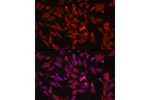 Immunofluorescence analysis of C6 cells using R Rabbit pAb (ABIN6132924, ABIN6146720, ABIN6146721 and ABIN6214772) at dilution of 1:100 (40x lens). (RASGRP1 anticorps  (AA 598-797))