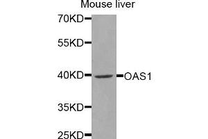 Western blot analysis of extracts of mouse liver, using OAS1 antibody (ABIN5971361) at 1/1000 dilution.