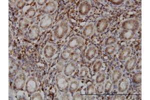 Immunoperoxidase of monoclonal antibody to SENP6 on formalin-fixed paraffin-embedded human stomach.