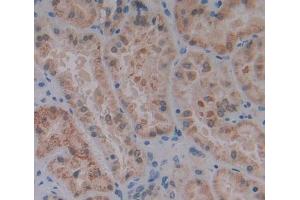 Used in DAB staining on fromalin fixed paraffin- embedded kidney tissue