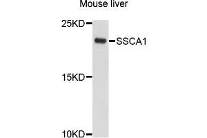 Western blot analysis of extracts of mouse liver cells, using SSSCA1 antibody. (SSSCA1 anticorps)