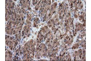 Image no. 2 for anti-Alcohol Dehydrogenase 1B (Class I), beta Polypeptide (ADH1B) antibody (ABIN1496479) (ADH1B anticorps)