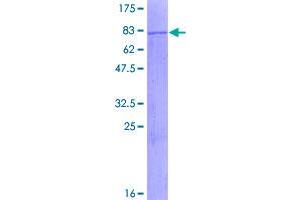 Image no. 1 for Malonyl CoA Decarboxylase (MLYCD) (AA 1-493) protein (GST tag) (ABIN1311035)