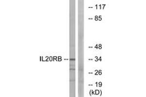 Western Blotting (WB) image for anti-Interleukin 20 Receptor beta (IL20RB) (AA 141-190) antibody (ABIN2889969) (IL20RB anticorps  (AA 141-190))
