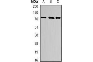 Western blot analysis of ATF6 expression in K562 (A), PC3 (B), mouse heart (C) whole cell lysates. (ATF6 anticorps)