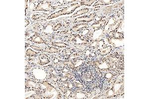 IHC analysis of SNRNP27 using anti-SNRNP27 antibody (ABIN7599614). (SNRNP27 anticorps  (AA 100-155))