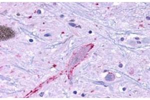 Immunohistochemical (Formalin/PFA-fixed paraffin-embedded sections) staining in human brain, neurons and glia with MRGF polyclonal antibody . (Mrgprf anticorps  (C-Term))