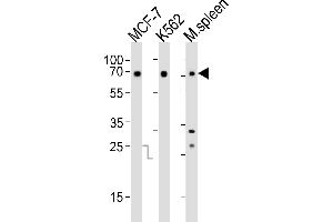 Western blot analysis of lysates from MCF-7, K562 cell line and mouse spleen tissue(from left to right), using RBBP5 Antibody (C-term) (ABIN6242596 and ABIN6577711). (RBBP5 anticorps  (C-Term))