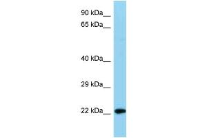 WB Suggested Anti-Ndufb8 Antibody   Titration: 1. (NDUFB8 anticorps  (C-Term))