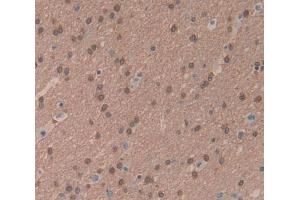 Used in DAB staining on fromalin fixed paraffin- embedded brain tissue