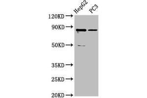 Western Blot Positive WB detected in: HepG2 whole cell lysate, PC-3 whole cell lysate All lanes: CCDC170 antibody at 5 μg/mL Secondary Goat polyclonal to rabbit IgG at 1/50000 dilution Predicted band size: 83 kDa Observed band size: 83 kDa (CCDC17 anticorps  (AA 574-651))
