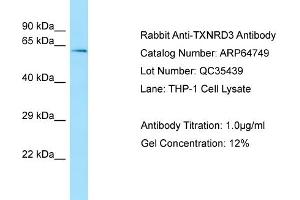 Western Blotting (WB) image for anti-Thioredoxin Reductase 3 (TXNRD3) (Middle Region) antibody (ABIN2789949) (TXNRD3 anticorps  (Middle Region))