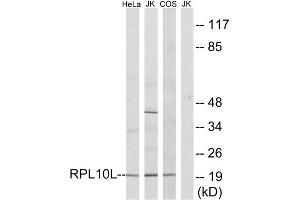 Western Blotting (WB) image for anti-Ribosomal Protein L10L (RPL10L) (C-Term) antibody (ABIN1850609) (RPL10L anticorps  (C-Term))