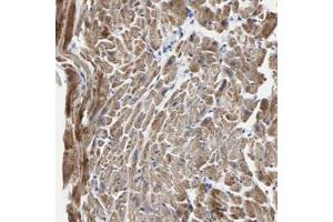 Immunohistochemical staining of human heart with NCAPH polyclonal antibody  shows strong cytoplasmic positivity in myocytes at 1:50-1:200 dilution. (NCAPH anticorps)