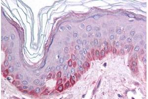 Human Skin (formalin-fixed, paraffin-embedded) stained with KCNK13 antibody ABIN214785 at 5 ug/ml followed by biotinylated goat anti-rabbit IgG secondary antibody ABIN481713, alkaline phosphatase-streptavidin and chromogen. (KCNK13 anticorps  (C-Term))