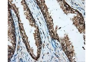 Immunohistochemical staining of paraffin-embedded Kidney tissue using anti-BSG mouse monoclonal antibody. (CD147 anticorps)