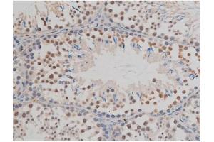 ABIN6267377 at 1/200 staining Mouse testis tissue sections by IHC-P. (GFAP anticorps  (pSer38))