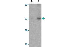 Western blot analysis of EMD in human skeletal muscle tissue lysate with EMD polyclonal antibody  at (A) 0. (Emerin anticorps  (N-Term))