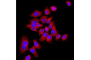 MCF-7 cells were stained with P21 Polyclonal Antibody, Unconjugated at 1:500 in PBS and incubated for two hours at 37°C followed by Goat Anti-Rabbit IgG (H+L) Cy3 conjugated secondary antibody. (p21 anticorps  (AA 21-100))