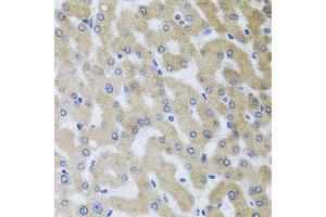Immunohistochemistry of paraffin-embedded human liver injury using UVRAG antibody.
