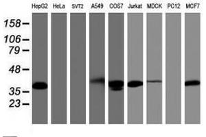 Image no. 3 for anti-PDZ and LIM Domain 2 (PDLIM2) antibody (ABIN1500130) (PDLIM2 anticorps)