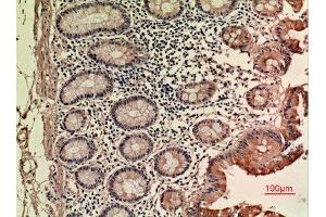Immunohistochemistry (IHC) analysis of paraffin-embedded Human Colon, antibody was diluted at 1:100. (LIF anticorps  (C-Term))