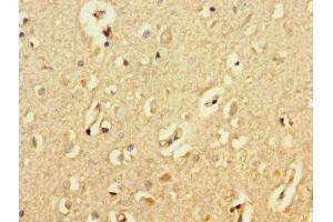 Immunohistochemistry of paraffin-embedded human brain tissue using ABIN7145091 at dilution of 1:100
