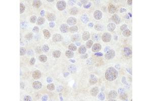 Immunohistochemistry (IHC) image for anti-Chromodomain Helicase DNA Binding Protein 3 (CHD3) (AA 1950-2000) antibody (ABIN7448475)