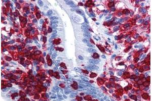 Human Small Intestine: Formalin-Fixed, Paraffin-Embedded (FFPE)