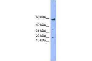 Image no. 1 for anti-LYR Motif Containing 1 (LYRM1) (AA 35-84) antibody (ABIN6744194) (LYRM1 anticorps  (AA 35-84))