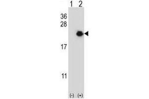 Western blot analysis of EIF4EBP1 (arrow) using rabbit polyclonal EIF4EBP1 Antibody (Center) . (eIF4EBP1 anticorps  (Middle Region))