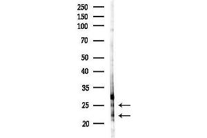 Western blot analysis of lysates from HepG2 cells(LPS, 4h treatment), using CLDN20 Antibody at 1/1000 dilution.