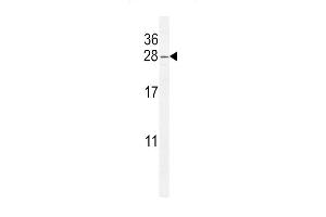 ARL8 Antibody (C-term) (ABIN655267 and ABIN2844860) western blot analysis in CEM cell line lysates (35 μg/lane). (ARL5B anticorps  (C-Term))