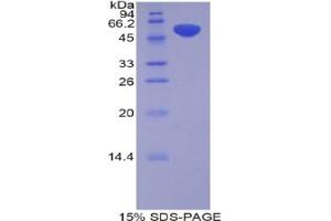 SDS-PAGE analysis of Rat Pregnancy Zone Protein. (PZP Protéine)